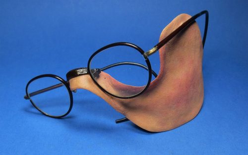 On a blue background rests a pair of black, oval-rimmed glasses, with a piece of pink painted metal attached. This prosthesis spans from the bridge of the nose, curving around the wearer's eyesocket to cover the left cheek, extending downwards to the jaw and back to the ear.